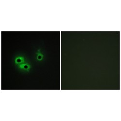 Anterior Gradient Protein 3 (AGR3) Antibody