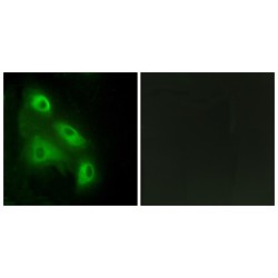 EPS8 Like 3 (EPS8L3) Antibody