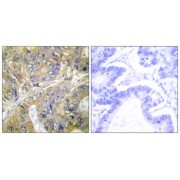 Immunohistochemistry analysis of paraffin-embedded human colon carcinoma tissue, using ES8L3 antibody.