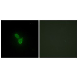 Par-3 Partitioning Defective 3 Homolog (PARD3) Antibody