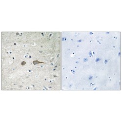 MAP Kinase-Activating Death Domain Protein (MADD) Antibody