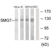 Western blot analysis of extracts from HeLa cells, Jurkat cells, 293 cells and HUVEC cells, using SMG7 antibody.