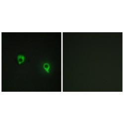 A Kinase Anchor Protein 1 (AKAP1) Antibody