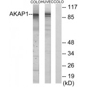 Western blot analysis of extracts from HUVEC cells and COLO cells, using AKAP1 antibody.