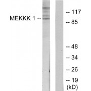 Western blot analysis of extracts from HepG2 cells, using MAP4K1/MEKKK 1 antibody. The lane on the right is blocked with the synthesized peptide.