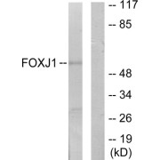 Western blot analysis of extracts from LOVO cells, using FOXJ1 antibody.