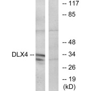 Western blot analysis of extracts from COLO cells, using DLX4 antibody.