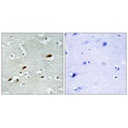 Immunohistochemistry analysis of paraffin-embedded human brain tissue, using TIP60 antibody.