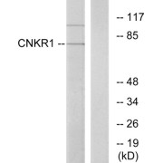Western blot analysis of extracts from COLO cells, using CNKR1 antibody.