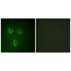 Prostate Transmembrane Protein Androgen Induced 1 (PMEPA1) Antibody