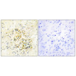 Prostate Transmembrane Protein Androgen Induced 1 (PMEPA1) Antibody