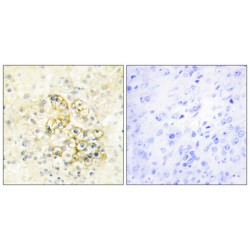 Prostate Transmembrane Protein Androgen Induced 1 (PMEPA1) Antibody