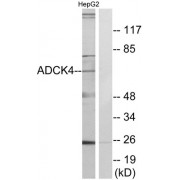 Western blot analysis of extracts from HepG2 cells, using ADCK4 antibody.