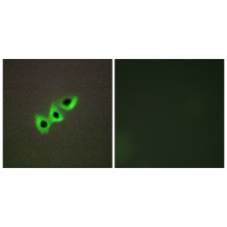 Rho GTPase-Activating Protein 7 (DLC1) Antibody