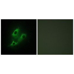 Serine Incorporator 2 (SERINC2) Antibody