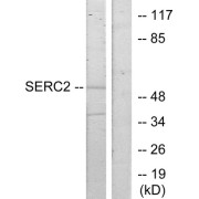 Western blot analysis of extracts from HeLa cells, using SERC2 antibody.