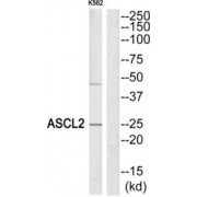 Achaete-Scute Family BHLH Transcription Factor 2 (ASCL2) Antibody