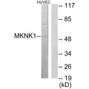 Western blot analysis of extracts from HuvEc cells, using MKNK1 antibody.