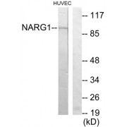 Western blot analysis of extracts from HUVEC cells, using NARG1 antibody.