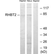 Western blot analysis of extracts from HepG2 cells and HeLa cells, using RHBT2 antibody.