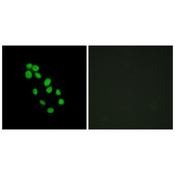 Iroquois Homeobox 2 (IRX2) Antibody