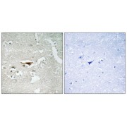 Immunohistochemistry analysis of paraffin-embedded human brain tissue, using IPKB antibody.