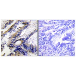 Integrin-Linked Kinase-Associated Serine/threonine Phosphatase 2C (ILKAP) Antibody