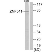 Western blot analysis of extracts from K562 cells, using ZNF541 antibody.