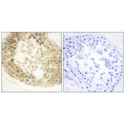 Immunohistochemistry analysis of paraffin-embedded human testis tissue, using ECRG4 antibody.