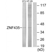 Western blot analysis of extracts from NIH-3T3 cells and HT-29 cells, using ZNF435 antibody.