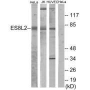 Western blot analysis of extracts from HeLa cells, Jurkat cells and HUVEC cells, using ES8L2 antibody.