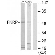 Western blot analysis of extracts from Jurkat cells and COLO205 cells, using FKRP antibody.