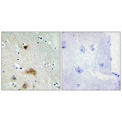 LAG1 Longevity Assurance Homolog 4 (LASS4) Antibody