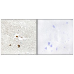 Zinc Finger Protein 287 (ZNF287) Antibody