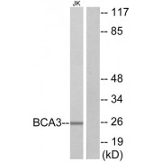 Western blot analysis of extracts from Jurkat cells, using BCA3 antibody.