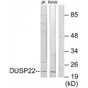Western blot analysis of extracts from Jurkat cells and RAW264.7 cells, using DUSP22 antibody.