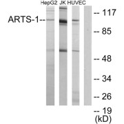 Western blot analysis of extracts from HepG2 cells, Jurkat cells and HUVEC cells, using ARTS-1 antibody.