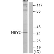 Western blot analysis of extracts from K562 cells, using HEY2 antibody.