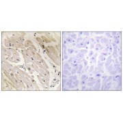 Immunohistochemistry analysis of paraffin-embedded human heart tissue, using PRKAG2 antibody.