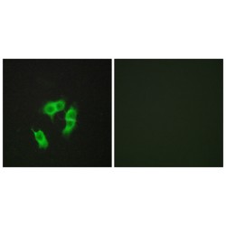 Armadillo Repeat-Containing X-Linked Protein 3 (ARMX3) Antibody