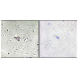 Armadillo Repeat-Containing X-Linked Protein 3 (ARMX3) Antibody