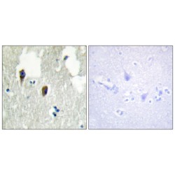Kelch-Like Protein 3 (KLHL3) Antibody