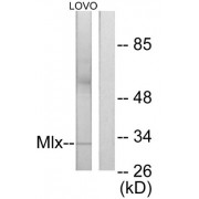 Western blot analysis of extracts from LOVO cells, using Mlx antibody.