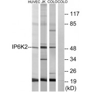 Western blot analysis of extracts from HUVEC cells, Jurkat cells and COLO cells, using IP6K2 antibody.