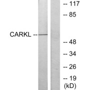 Western blot analysis of extracts from Jurkat cells, using CARKL antibody.