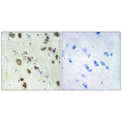 Ribosomal Protein S6 Kinase Alpha-6 (S6K alpha 6) Antibody