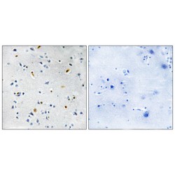 Differentially Expressed In Cancerous And Non-Cancerous Lung Cells 2 (DIL-2) Antibody
