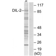 Western blot analysis of extracts from Jurkat cells, using DIL-2 antibody.