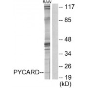 Western blot analysis of extracts from RAW264.7 cells, using ASC antibody.