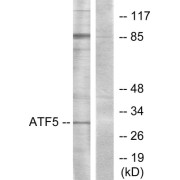 Western blot analysis of extracts from Jurkat cells, using ATF5 antibody.